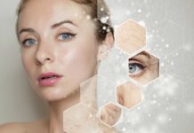 Treatment cho nền da mỏng yếu liệu có ổn không?